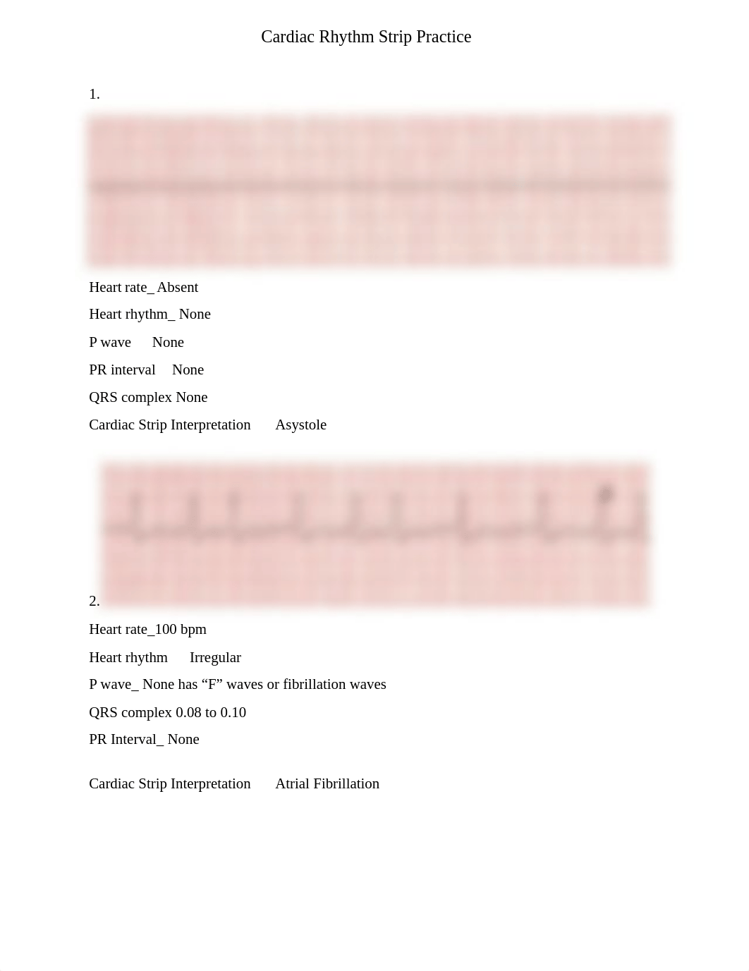 EKG Rhythm Practice .docx_d78q5btzmy4_page1