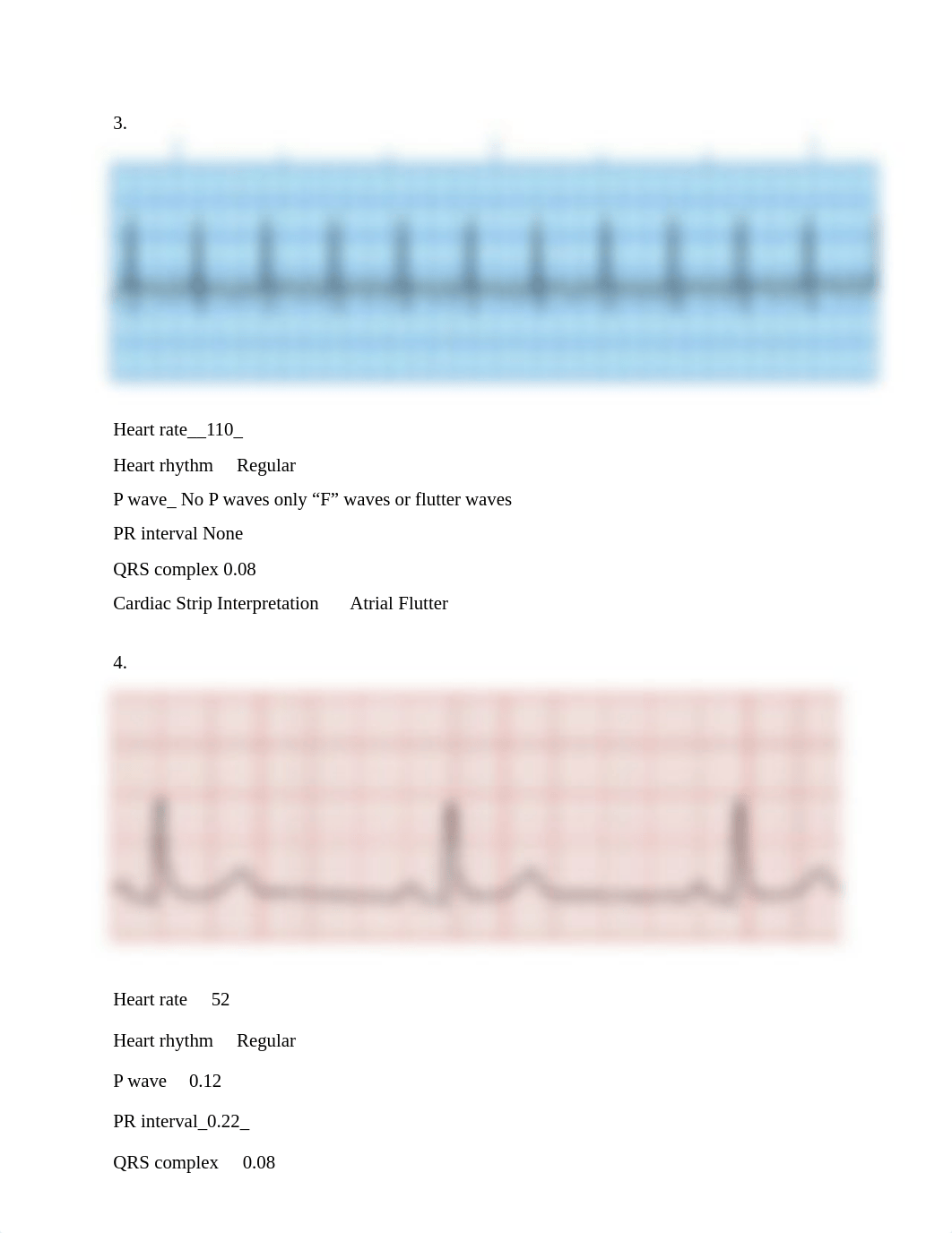 EKG Rhythm Practice .docx_d78q5btzmy4_page2