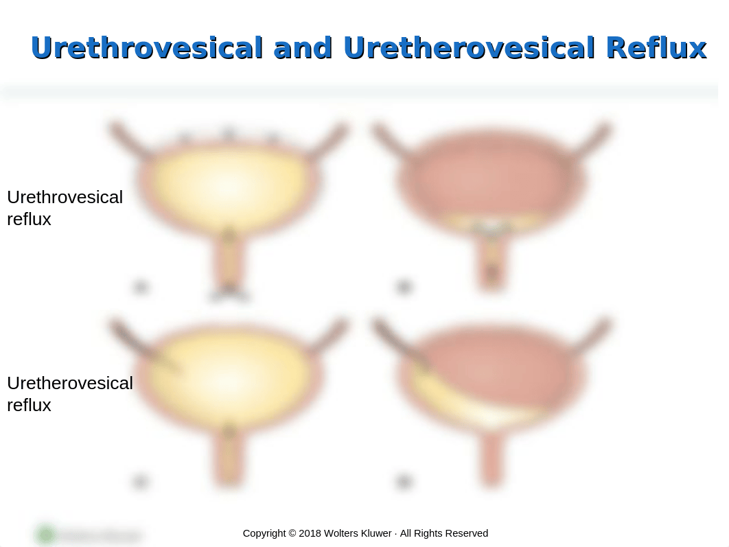 Chapter_55_Management_of_Patients_With_Urinary_Disorders_-_students.ppt_d7cnvptolva_page4