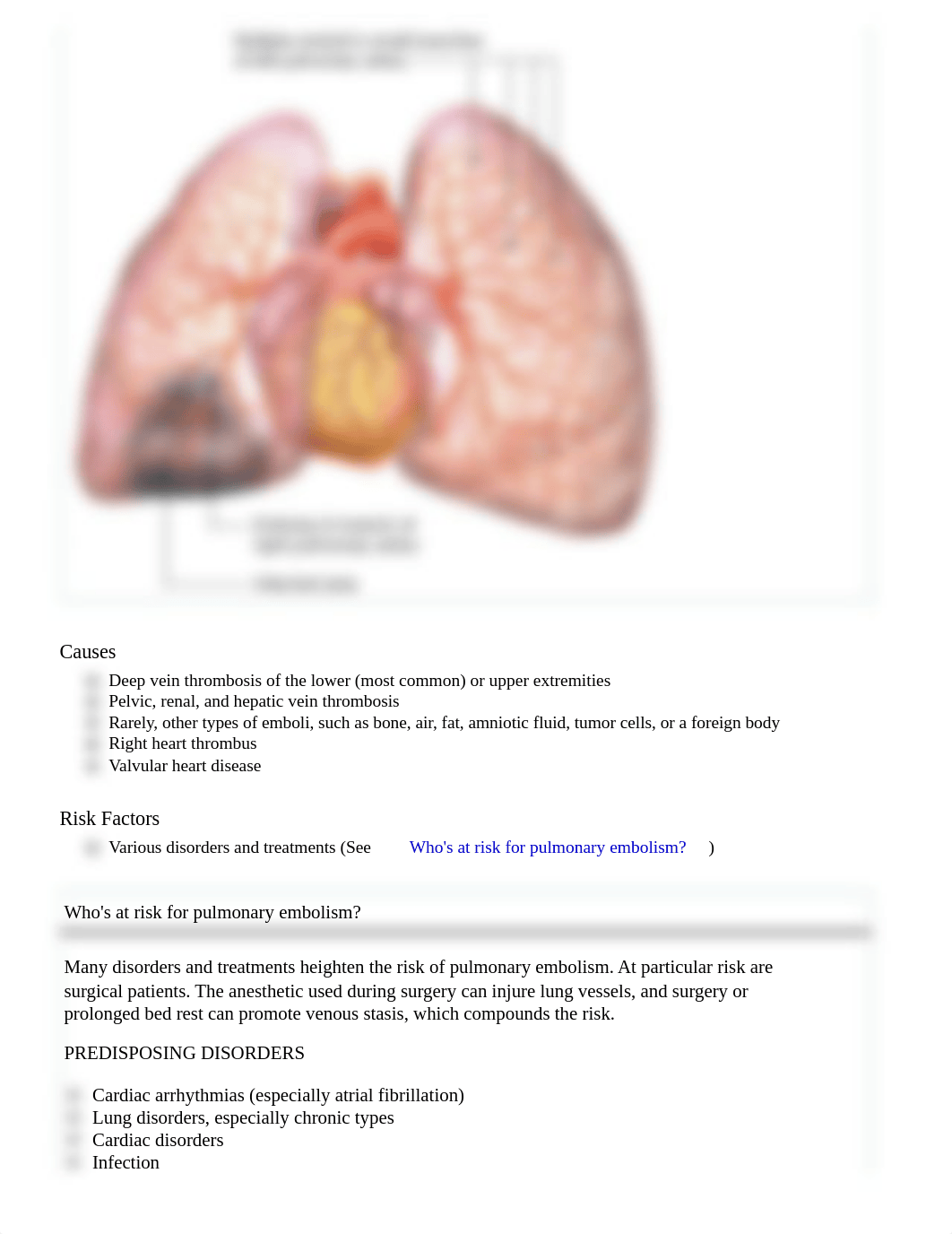 Pulmonary Embolism (Lippincott Advisor).pdf_d7f9hgxhzze_page2