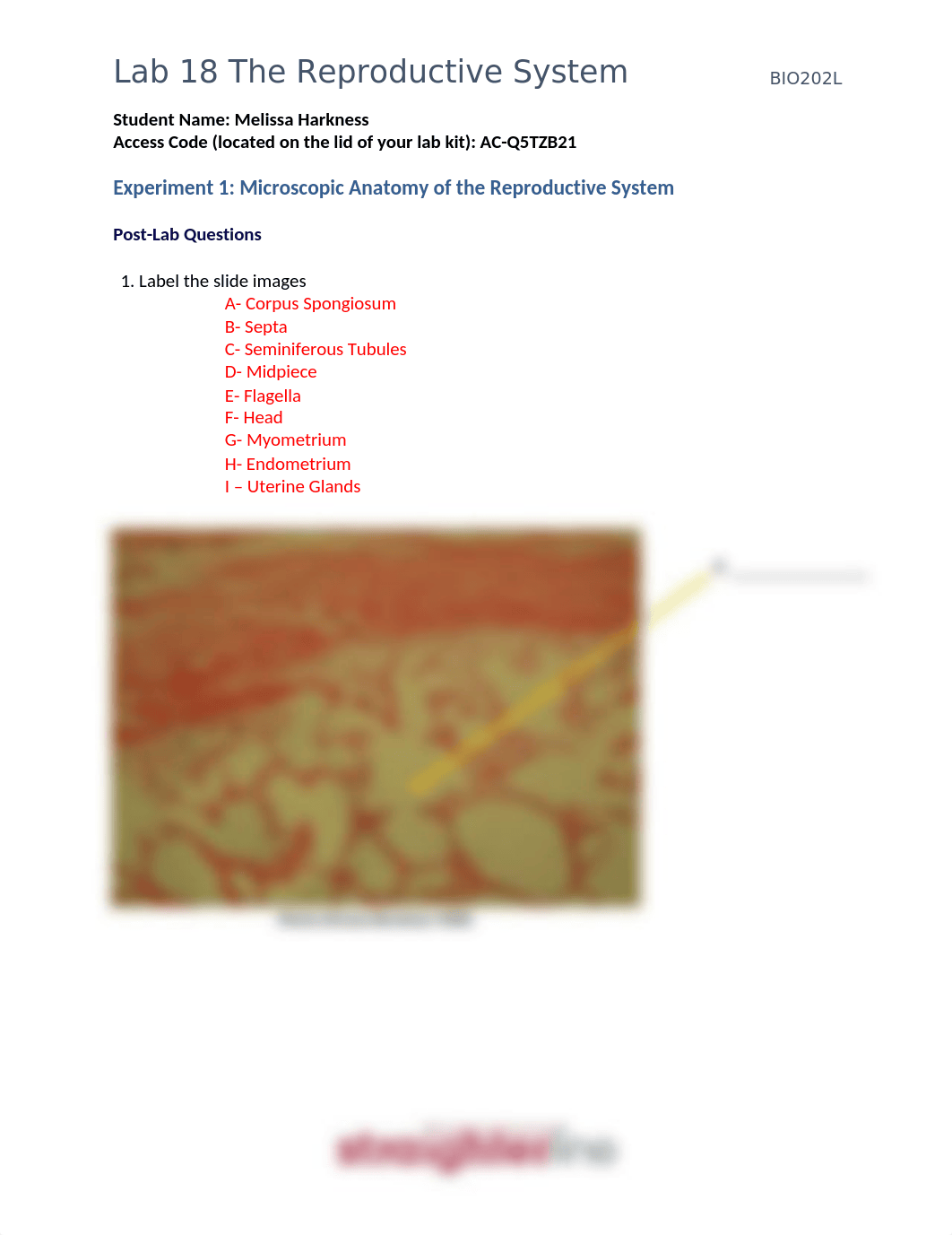 Lab 18 Reproductive System. Melissa harkness.docx_d7gejc785c2_page1