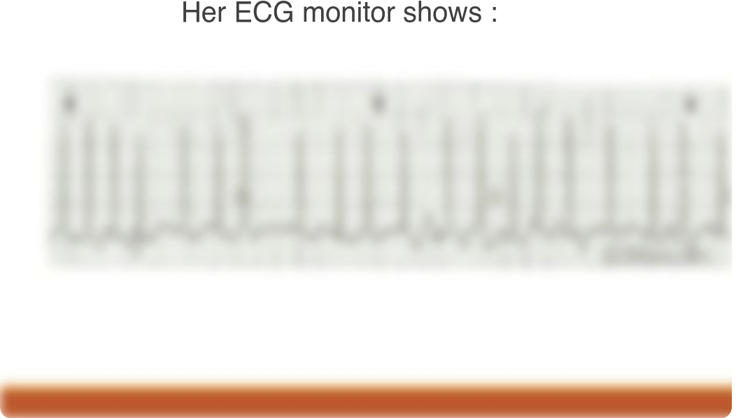 CASE STUDY Dysrhythmia with answers.pdf_d7i6dodupzx_page3