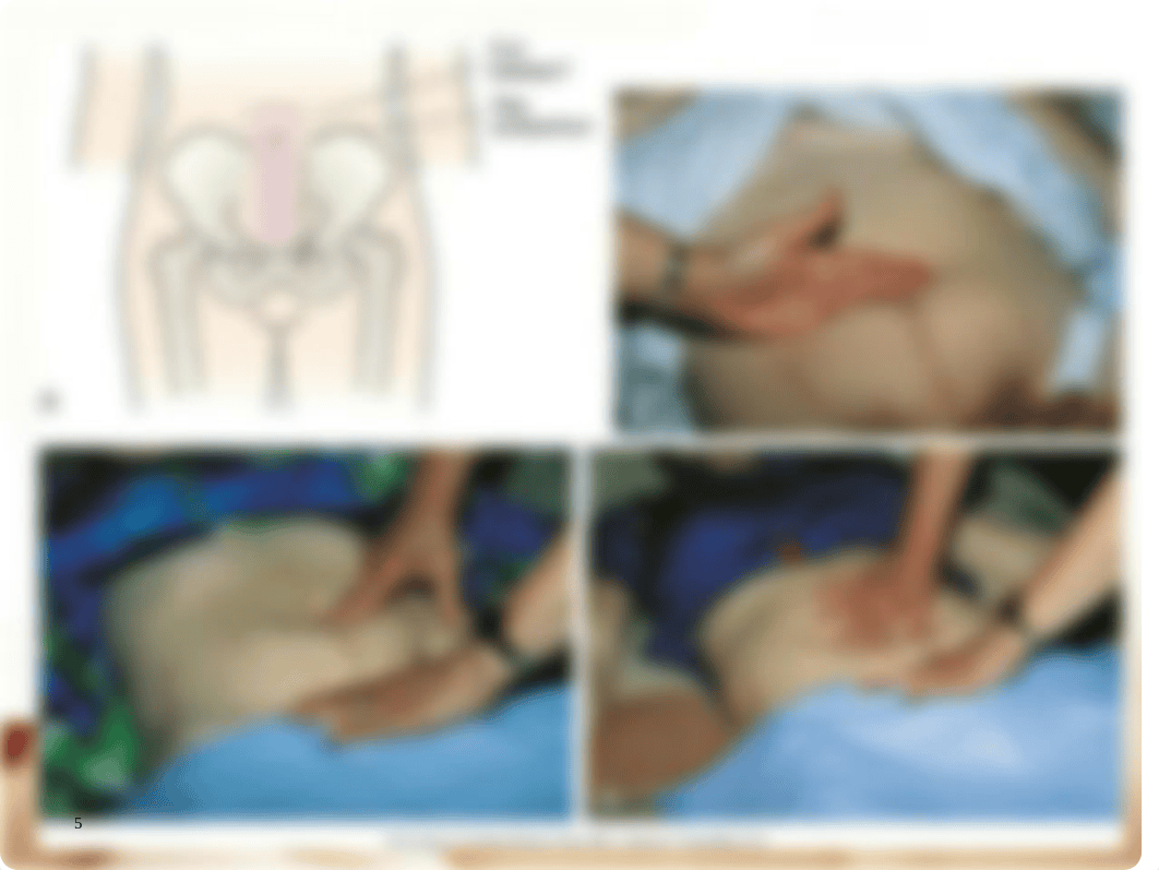 SP_2019_Chapter_15_-Postpartum_Adaptations_1.ppt_d7p9obl37lw_page5