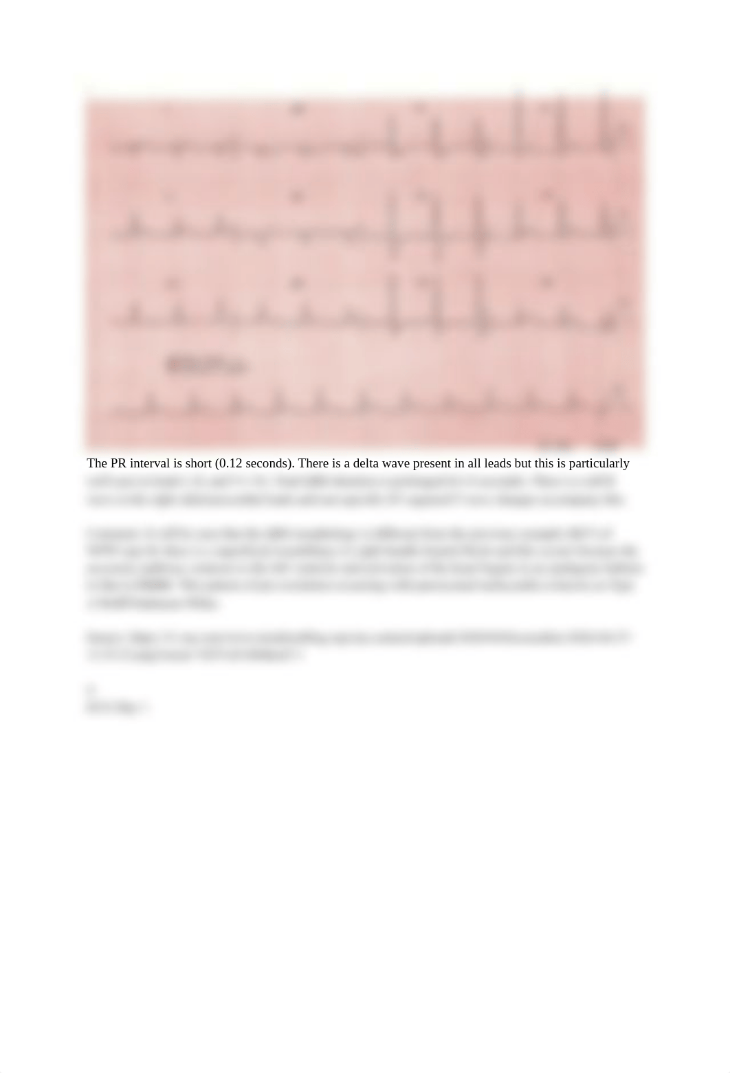 PAL5305 ECG Practice Quiz 1 with Answers.docx_d7p9ogfmp2r_page3