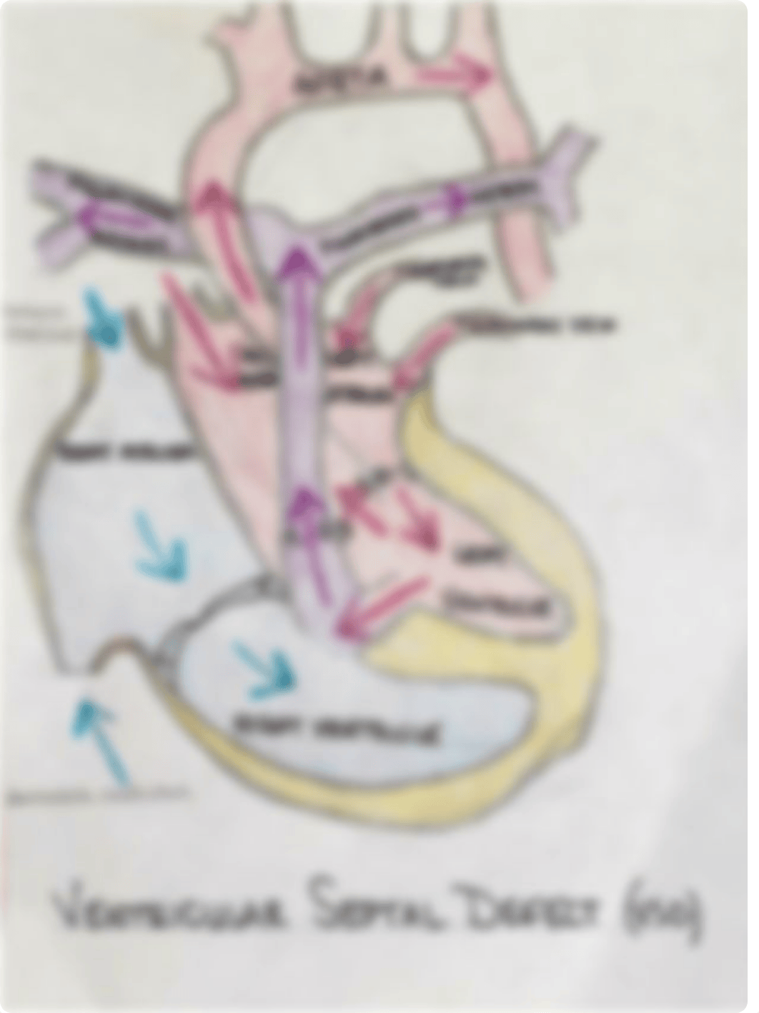 Drawings for Cardiac Defect Assignment .pdf_d7secbjhk01_page2