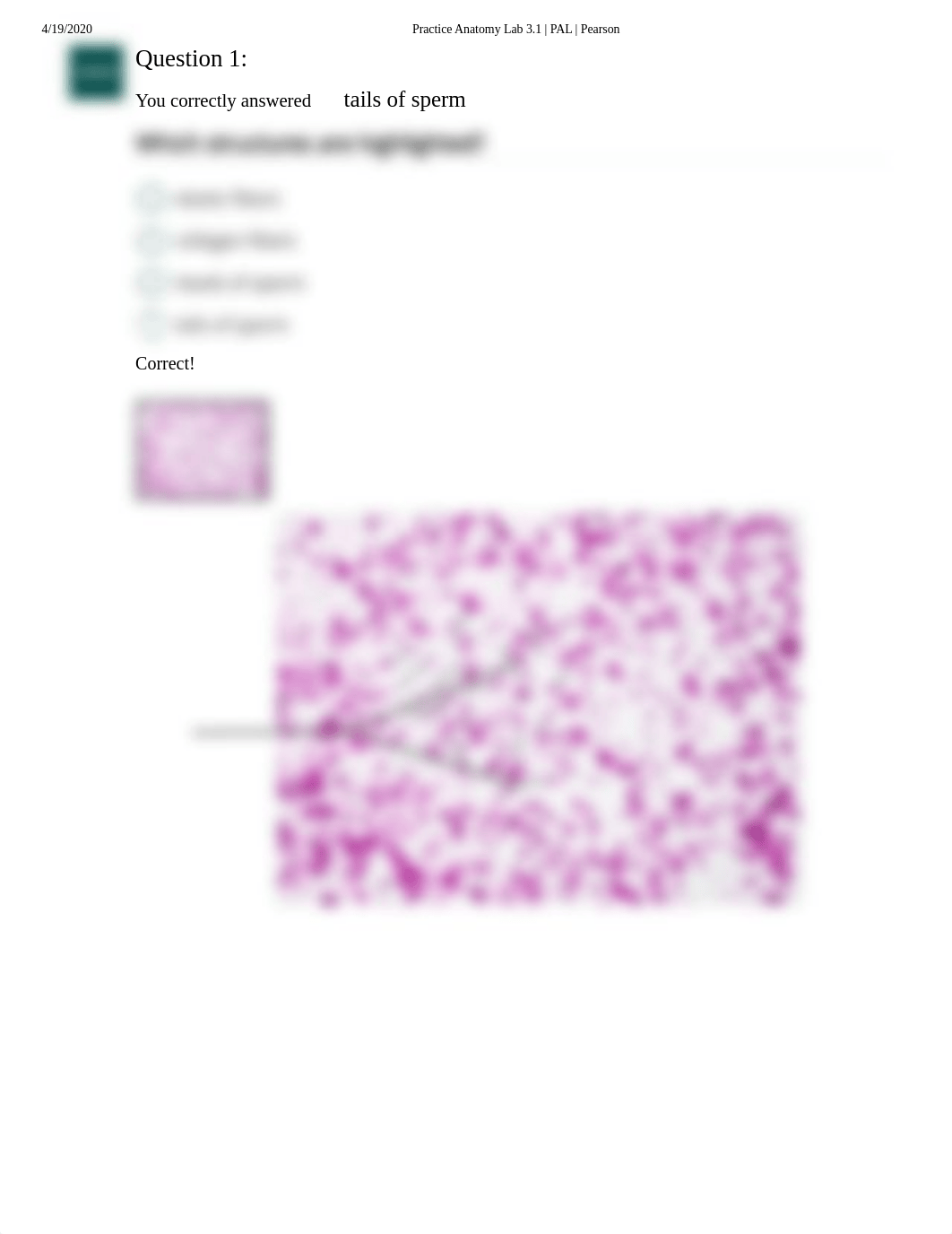 Doris Bowdre Histology  Reproductive System Quiz.pdf_d7sfqb9d0d0_page2