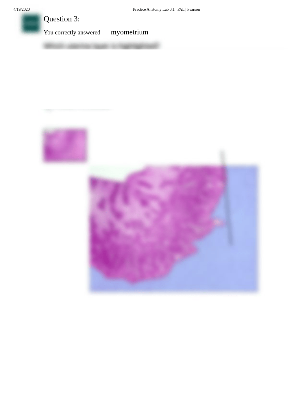 Doris Bowdre Histology  Reproductive System Quiz.pdf_d7sfqb9d0d0_page4