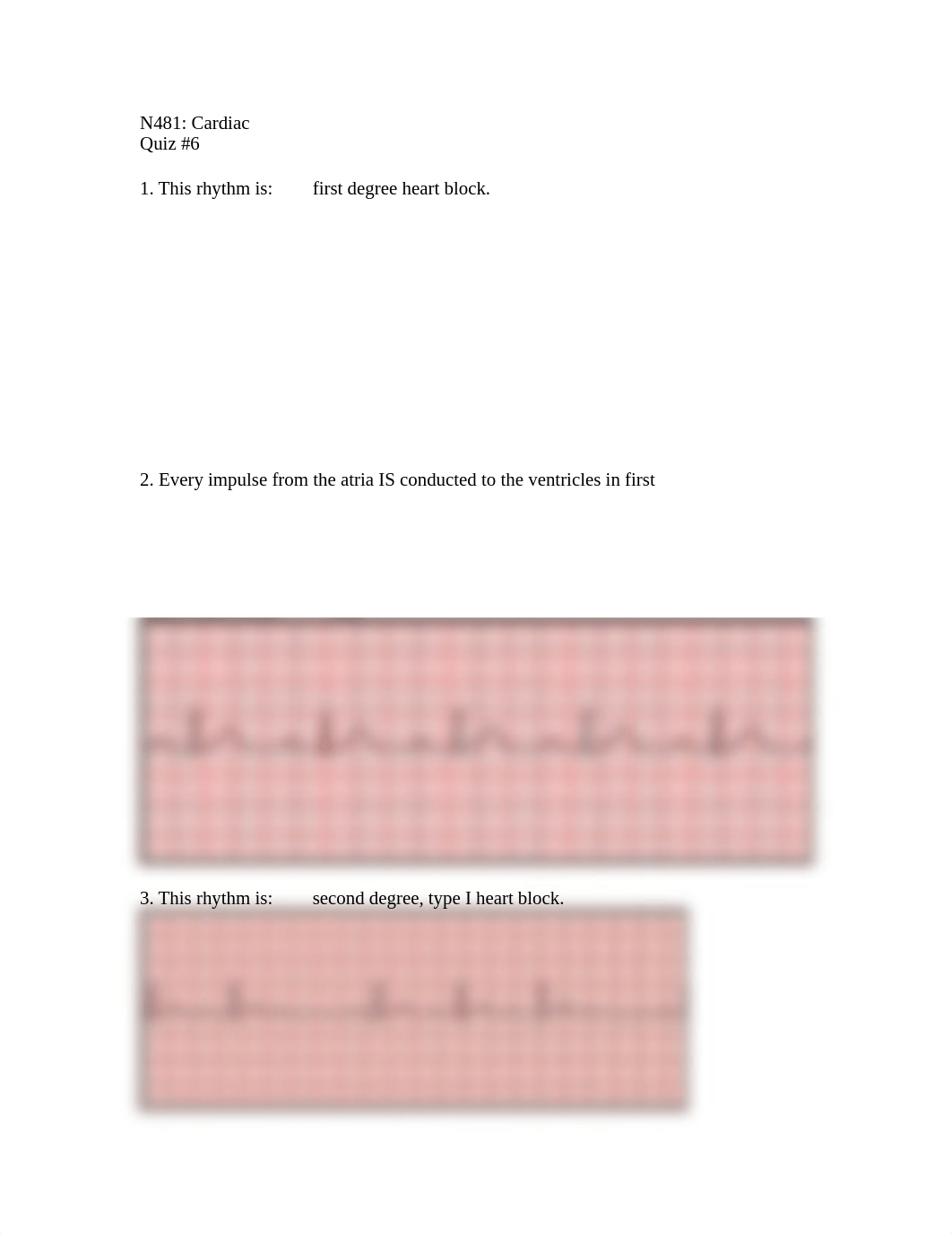 Cardiac Quiz #6.docx_d7u51f576l2_page1