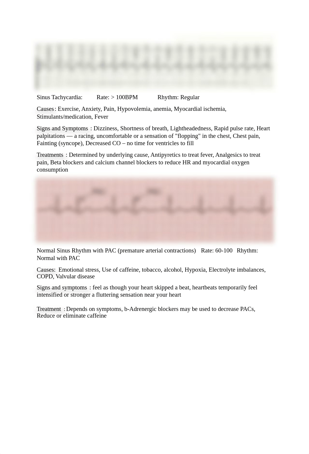 Reading EKG.docx_d7xuvg8f4dh_page2