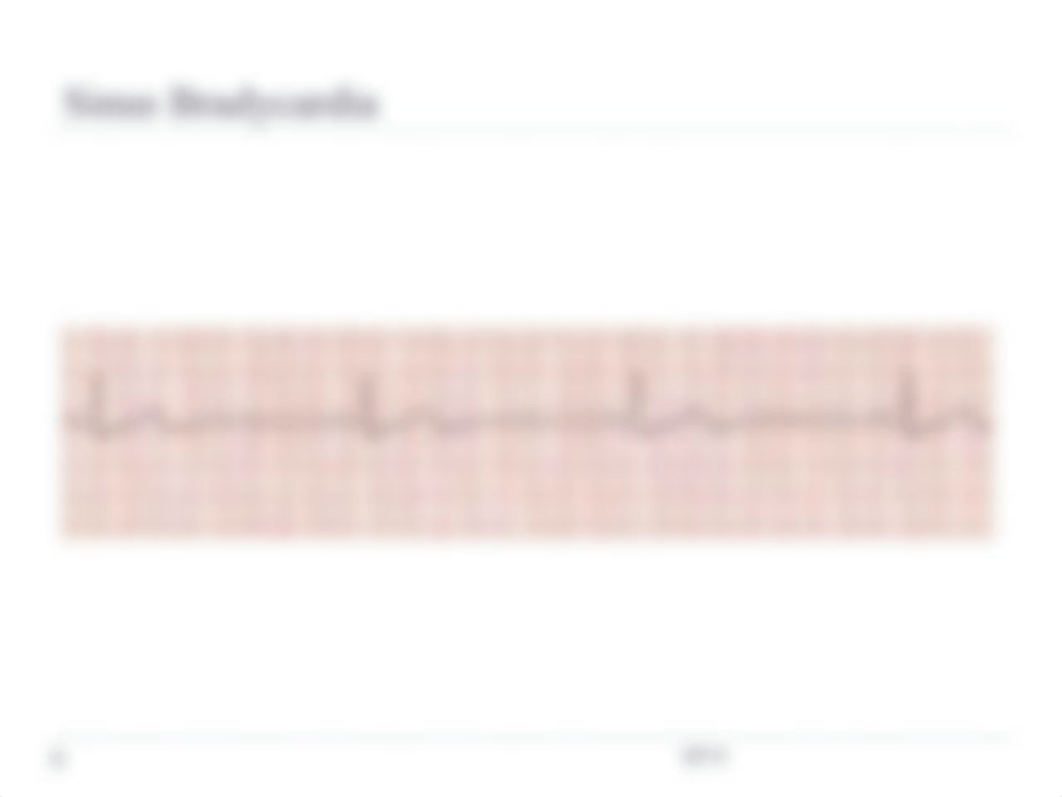 EKG_quiz_study_guide_(1).ppt_d7zqklwlr8s_page4