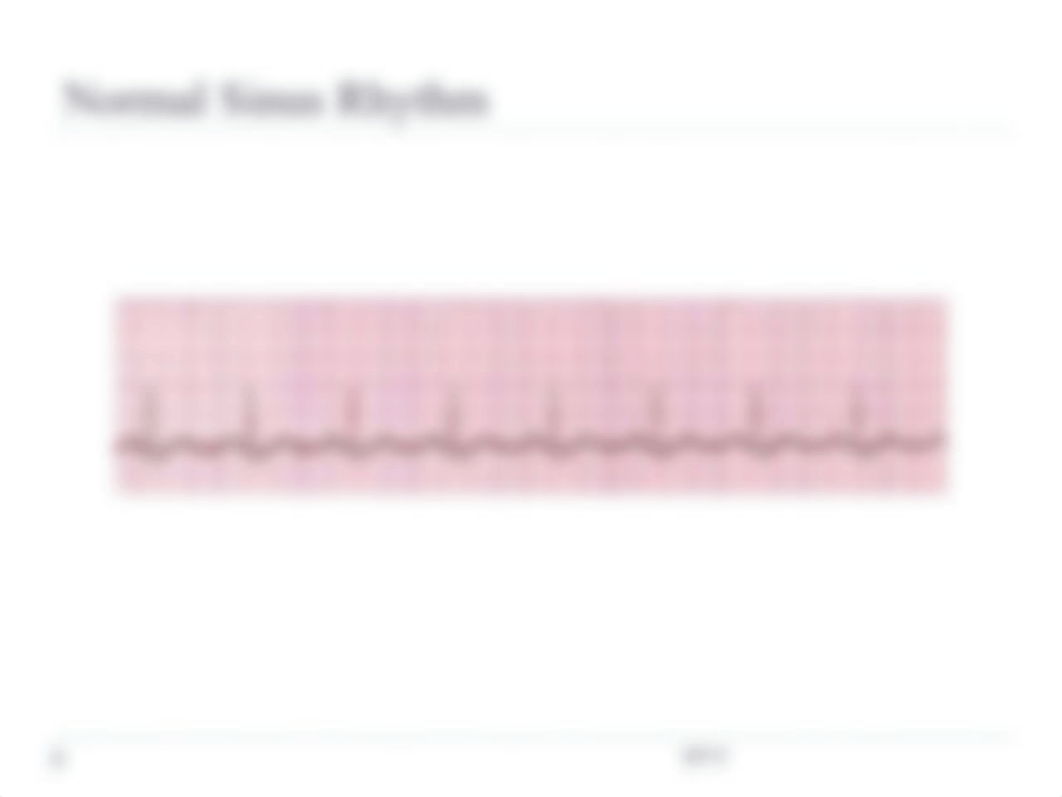 EKG_quiz_study_guide_(1).ppt_d7zqklwlr8s_page3