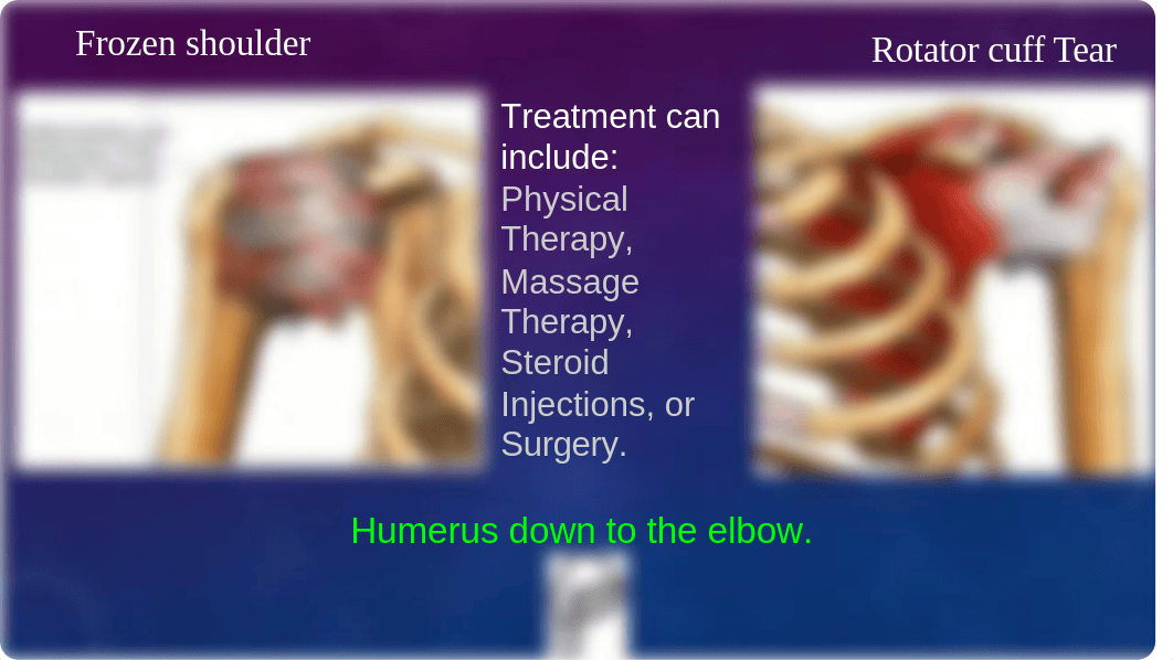 Muscle Presentation.pptx.odp_d7zyywgt7qc_page5