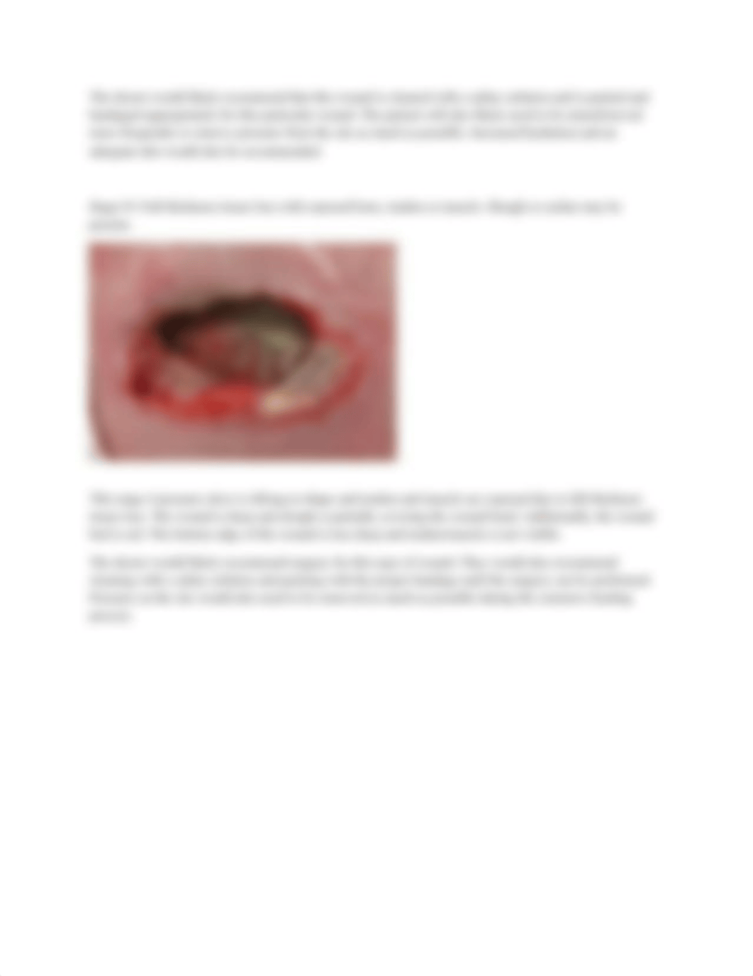 Wound Care Activity.docx_d80qf1rb7yu_page3