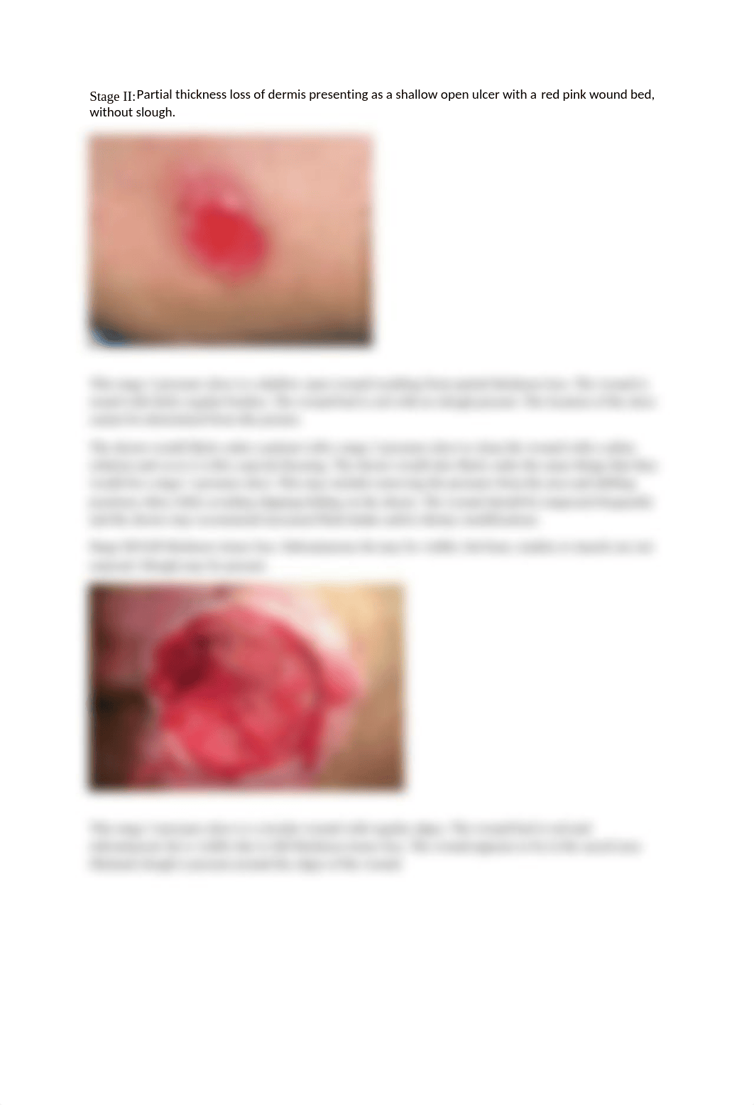 Wound Care Activity.docx_d80qf1rb7yu_page2