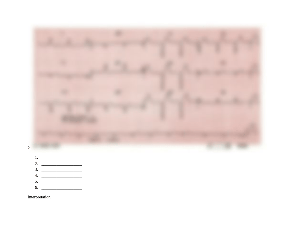 12_lead_PracticeEKGs_Answers.docx_d842d6i3w5a_page2