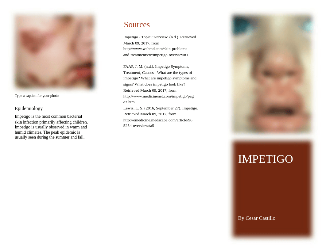 Impetigo Brochure.pptx_d89i65laia6_page1