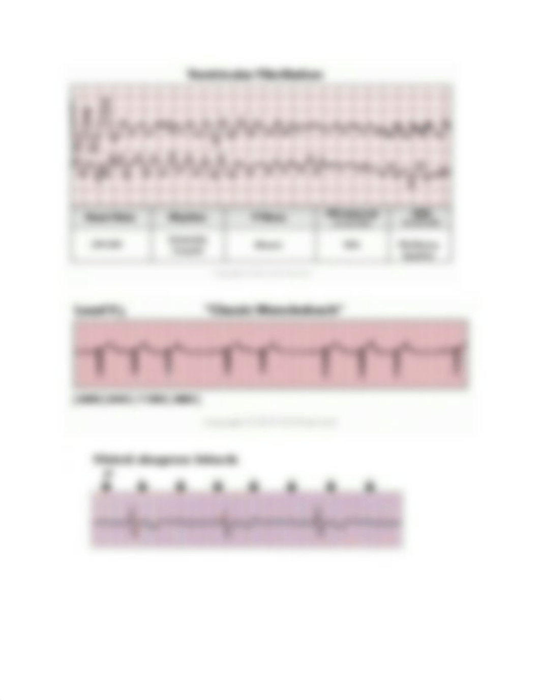 Ekg Strips.docx_d8b8wbk1d9j_page4