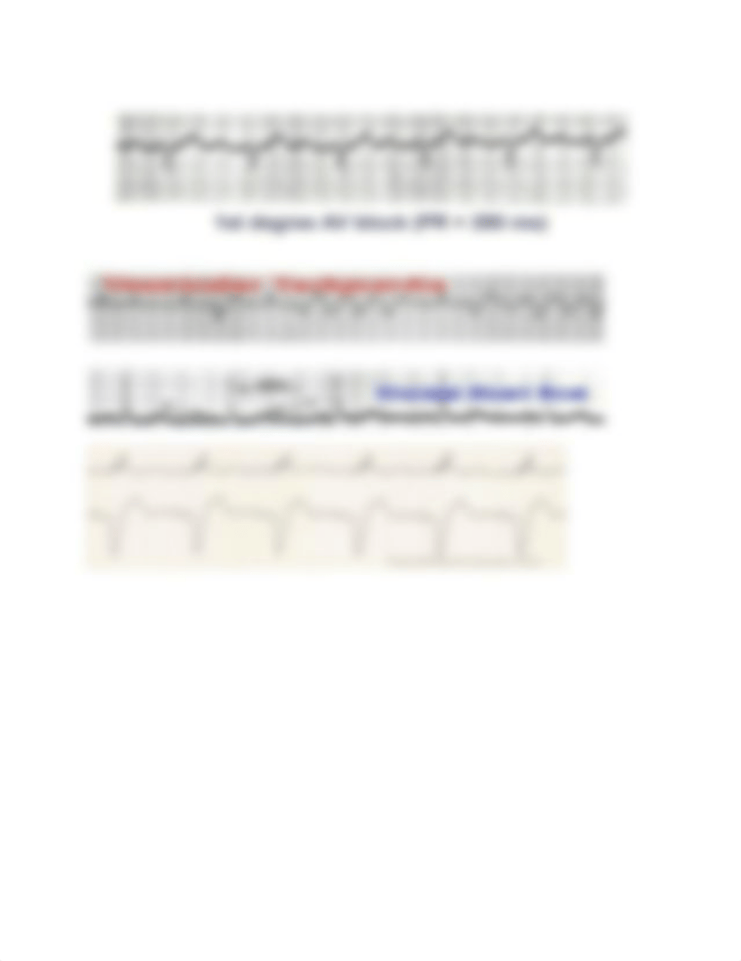 Ekg Strips.docx_d8b8wbk1d9j_page5