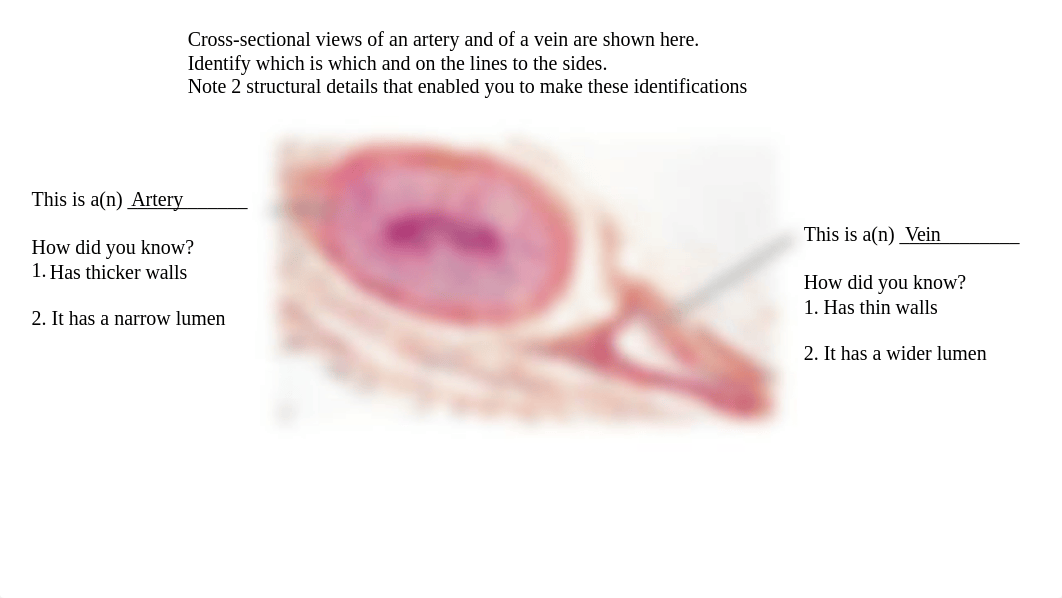 Lab 5 Worksheet 1 Blood vessel histology.pptx_d8cyjcc2de9_page1