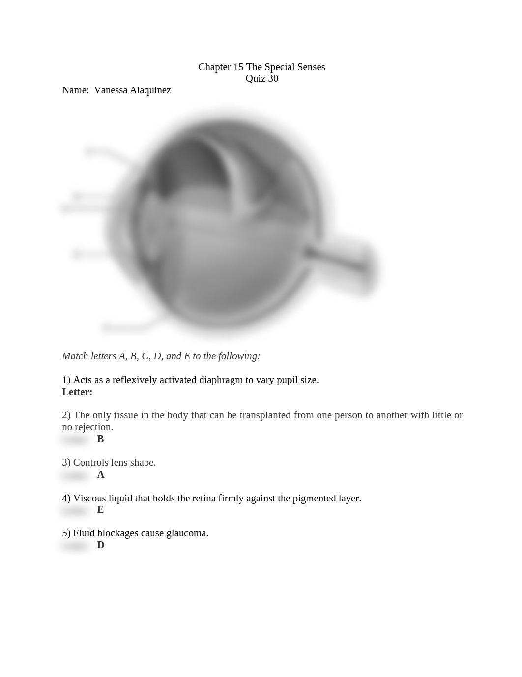 Ch. 15 quiz 30 The Special Senses.docx_d8dr7z3uo1a_page1