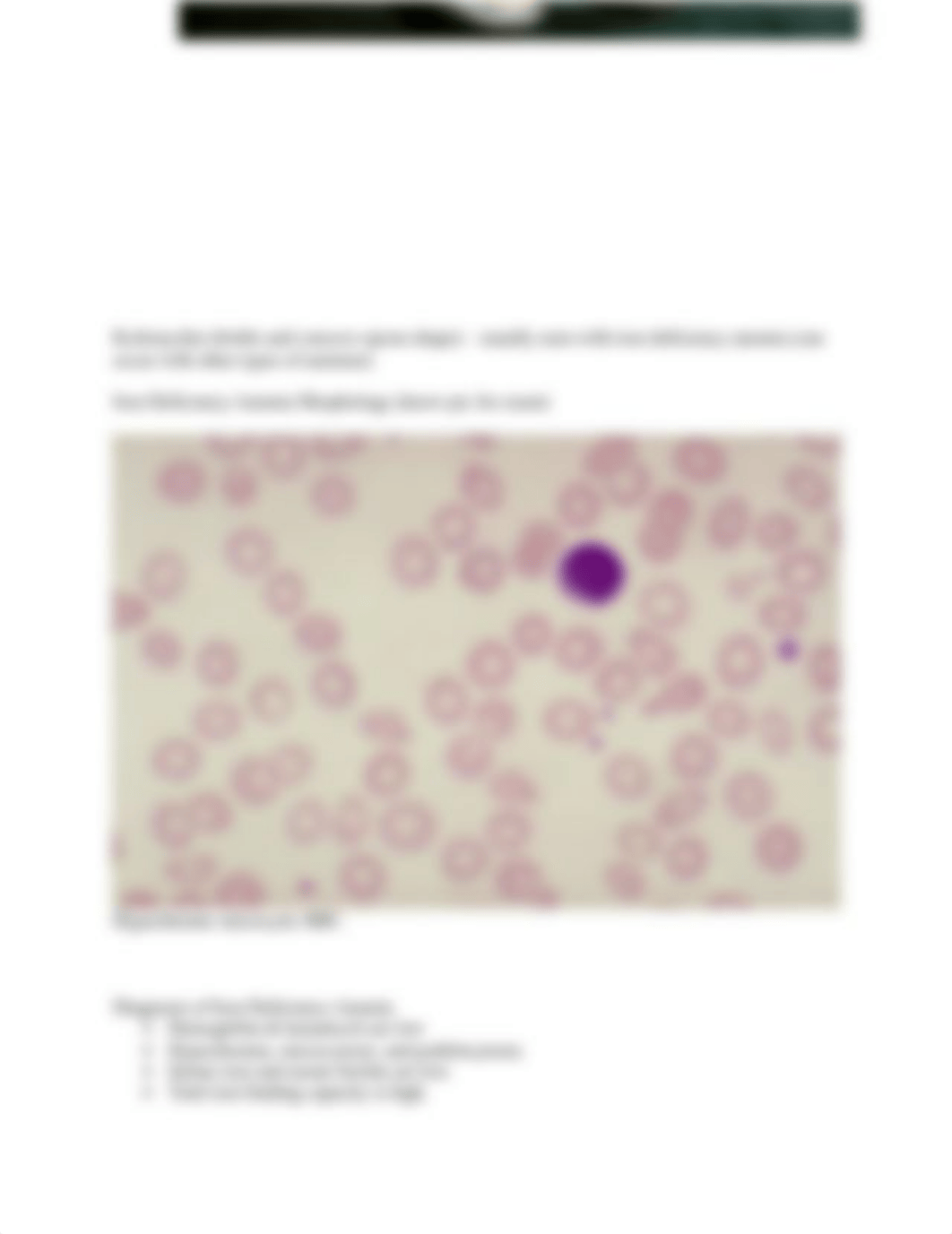 Polycythemia.docx_d8gu7ykl7o2_page4