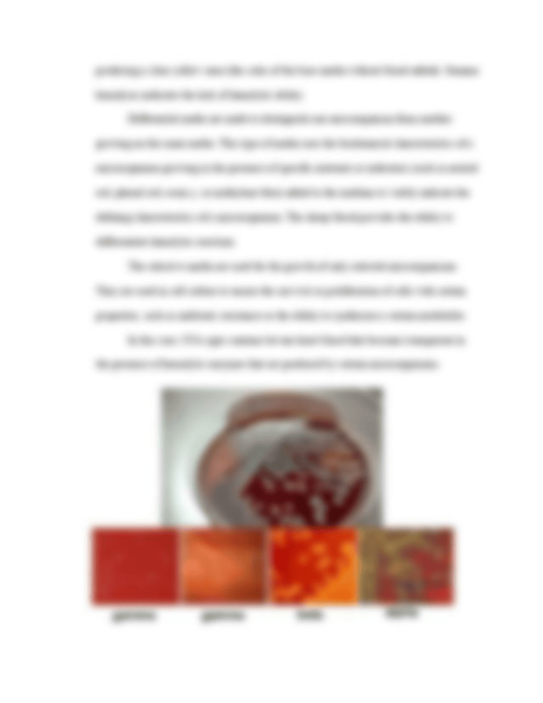 Microbiology Lab Exam- Maddy Edwards.pdf_d8k4jvigjlj_page5