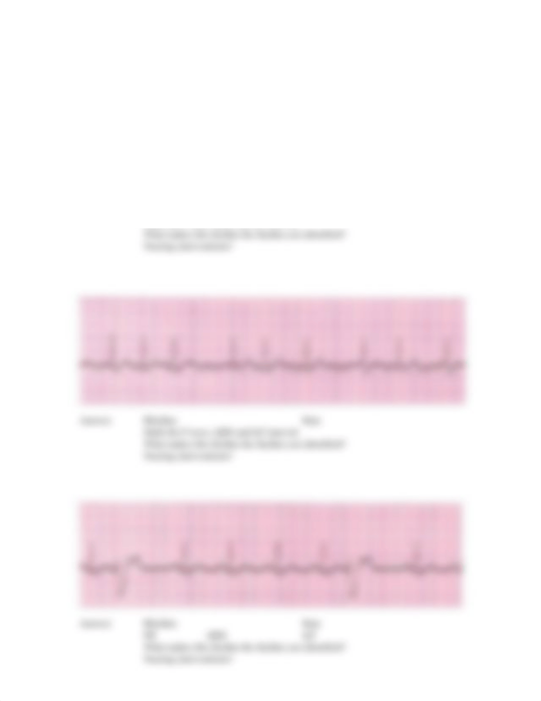 EKG strips Class Activity.pdf_d8l5zea2xyz_page2