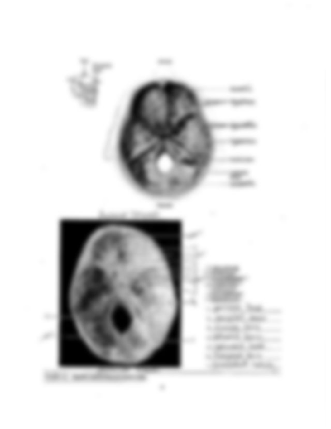 Lab 2 Exam Supplement (Bone Labeling) .pdf_d8mqcsfk3s7_page4