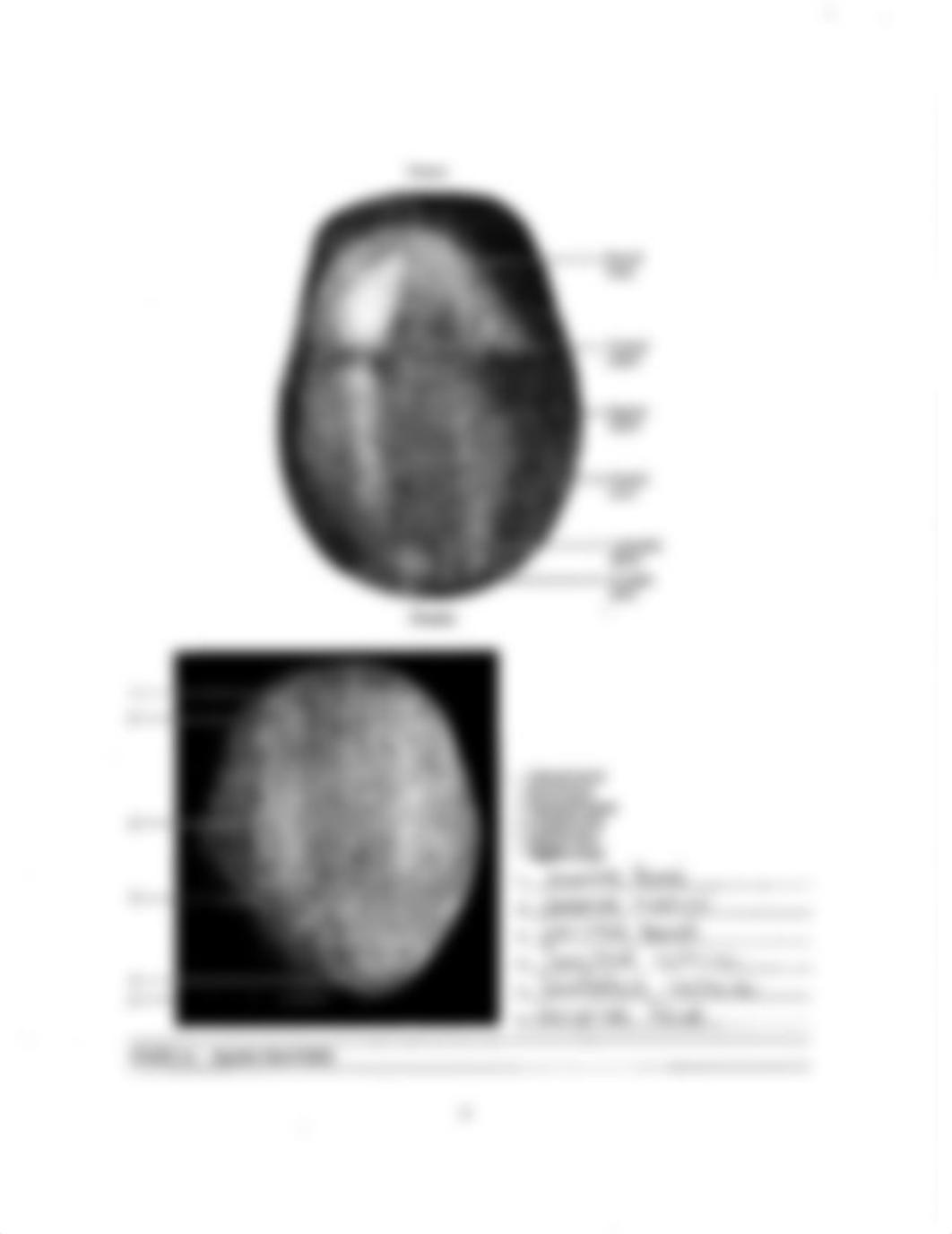 Lab 2 Exam Supplement (Bone Labeling) .pdf_d8mqcsfk3s7_page2