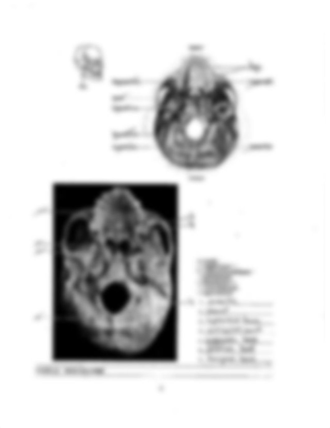 Lab 2 Exam Supplement (Bone Labeling) .pdf_d8mqcsfk3s7_page3