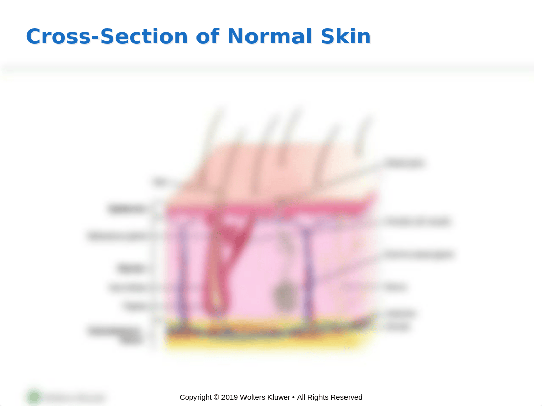 Ch. 32 Skin Integrity & Wound Care PPT.pptx_d8o3d9zjcww_page5