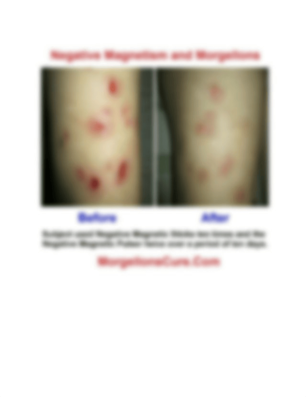 Morgellons Cure - Copy.docx_d8sd3y7jkxs_page5