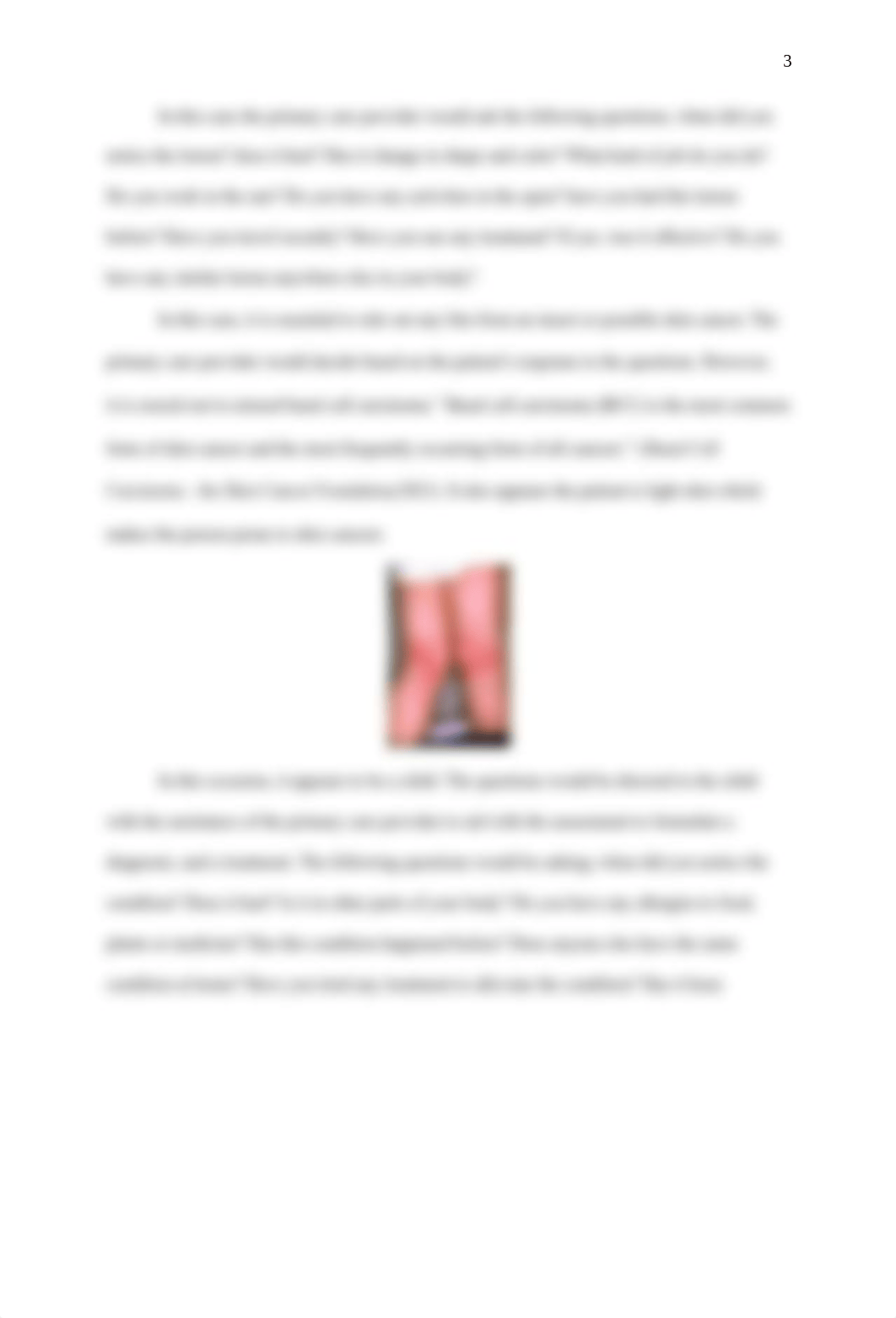 Dermatology History and Physical Nurse 602.docx_d8ws7ofghkl_page3