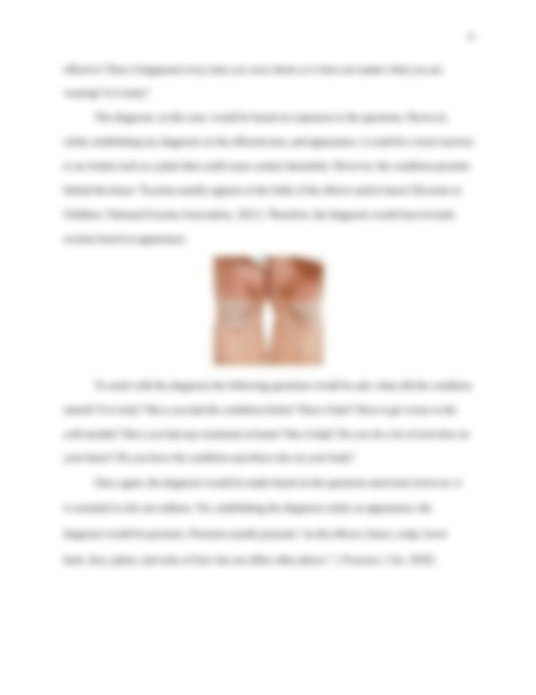 Dermatology History and Physical Nurse 602.docx_d8ws7ofghkl_page4