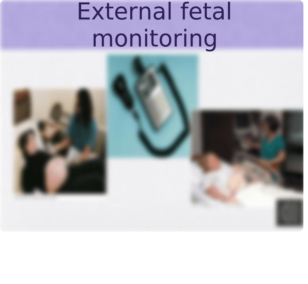 Module 3 Labor and Delivery Assessment.pptx_d8xsznzicd7_page5