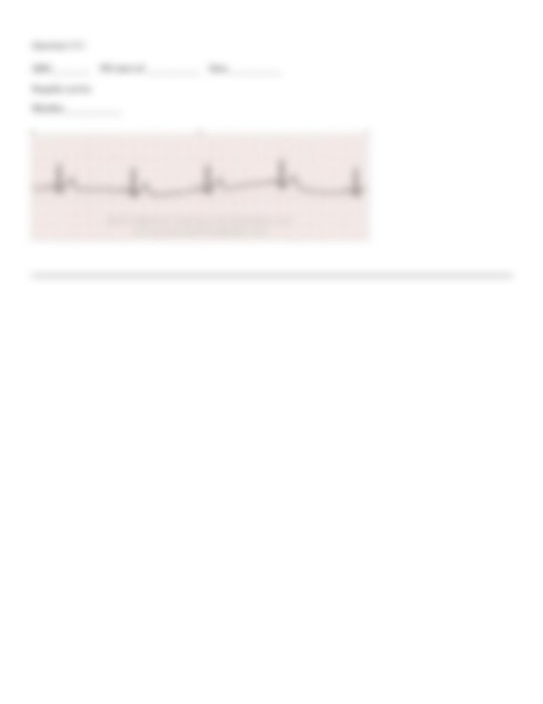 ECG Skills Activitystudent(1).doc_d92qu6xm6rl_page5