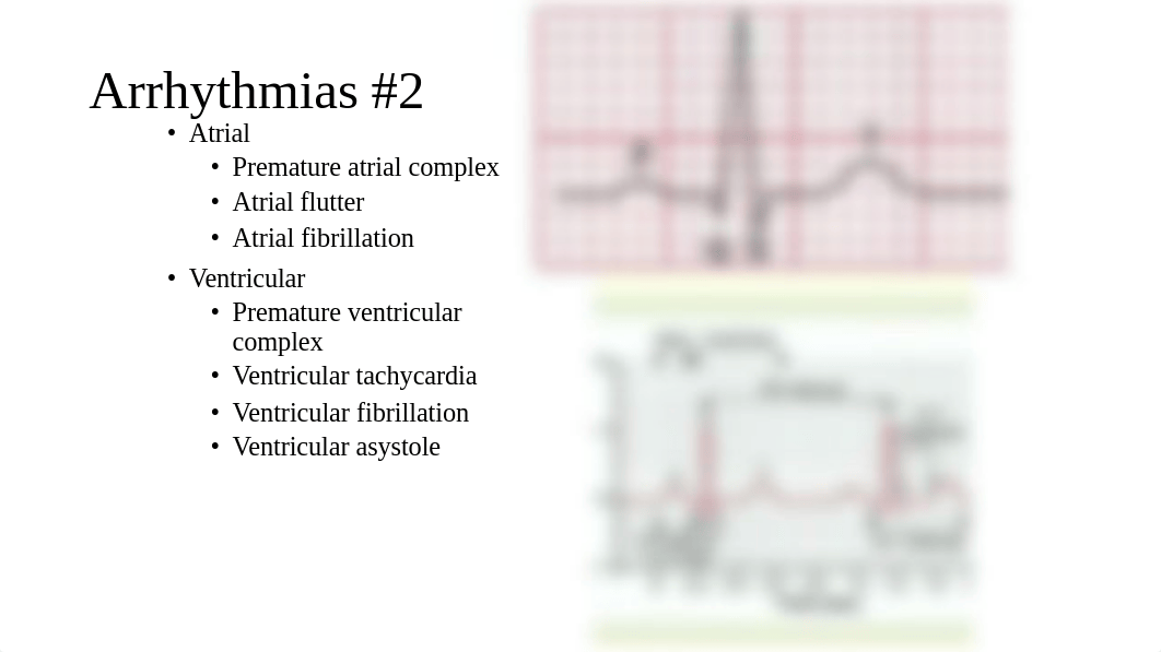 Chapter 22 with EKG (1).pdf_d96y21nlbmp_page3