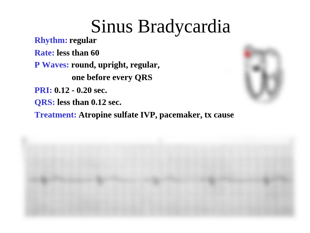 Part 2 Basic ECG interpretation Atrial and Ventricular Part 2 (1).pdf_d9hfj0ywufz_page3