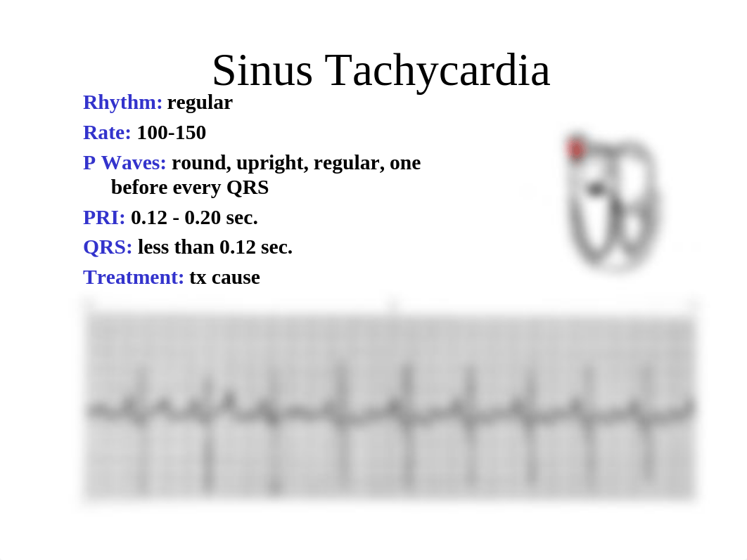 Part 2 Basic ECG interpretation Atrial and Ventricular Part 2 (1).pdf_d9hfj0ywufz_page4