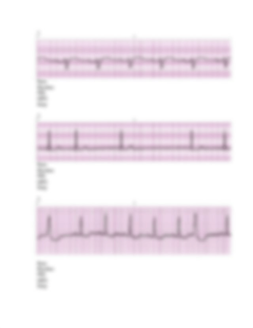 Basic Rhythm Interpretation Worksheet.doc_d9iter36wli_page2