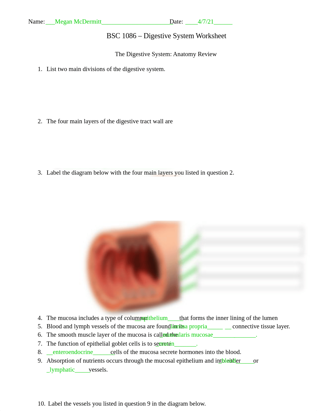 BSC 1086 - Digestive System Worksheet.docx_d9m5249juo8_page1