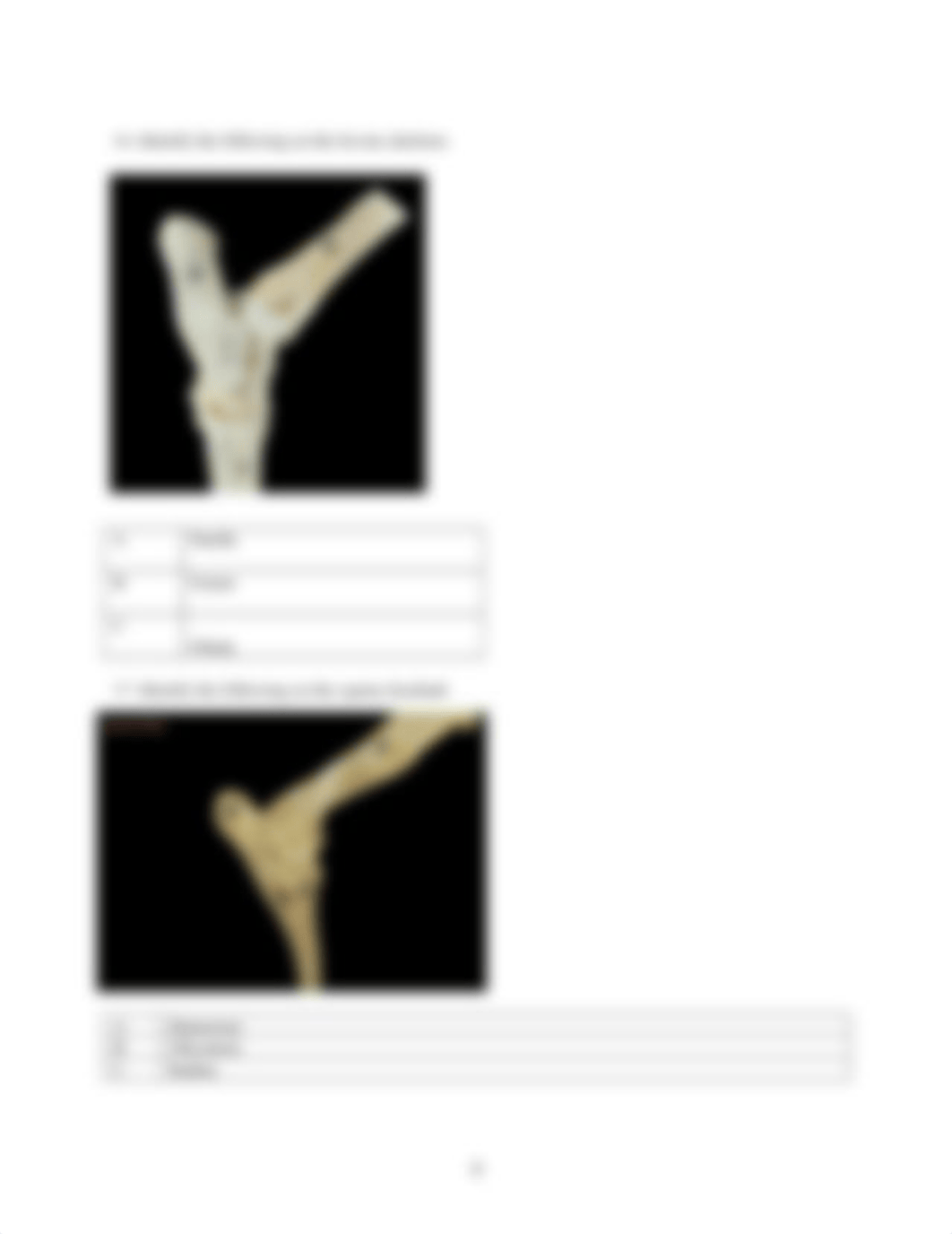 ASSIGNMENT 3.2 THE SKELETAL SYSTEM Finished.docx_d9mbi9d9np9_page4