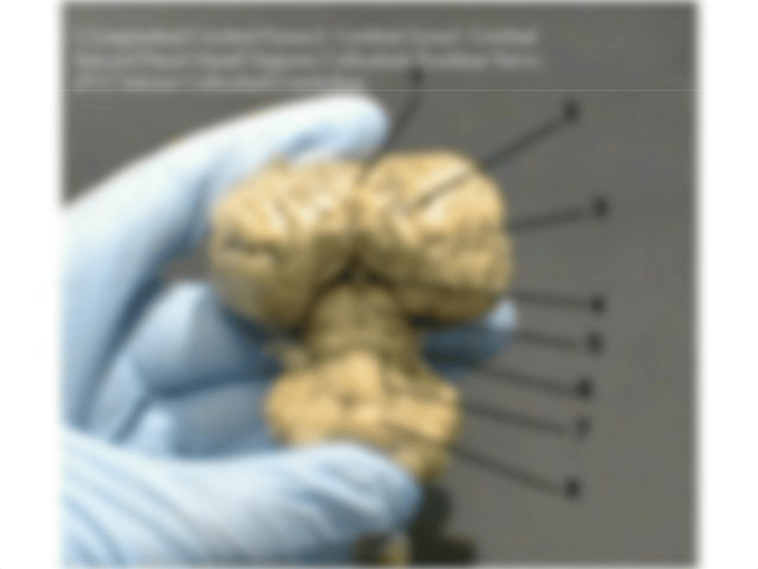 Sheep Brain Dissection_d9n94o44hzs_page5