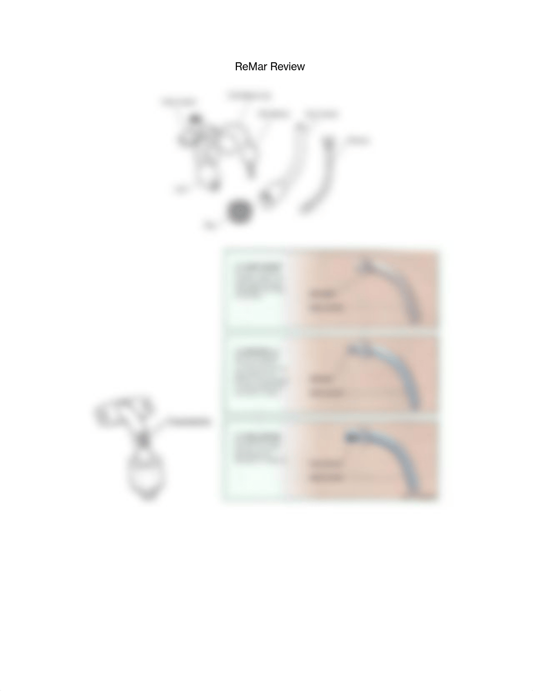 Tracheostomy-Basics-for-NCLEX.pdf_d9p6jf4dvw5_page2