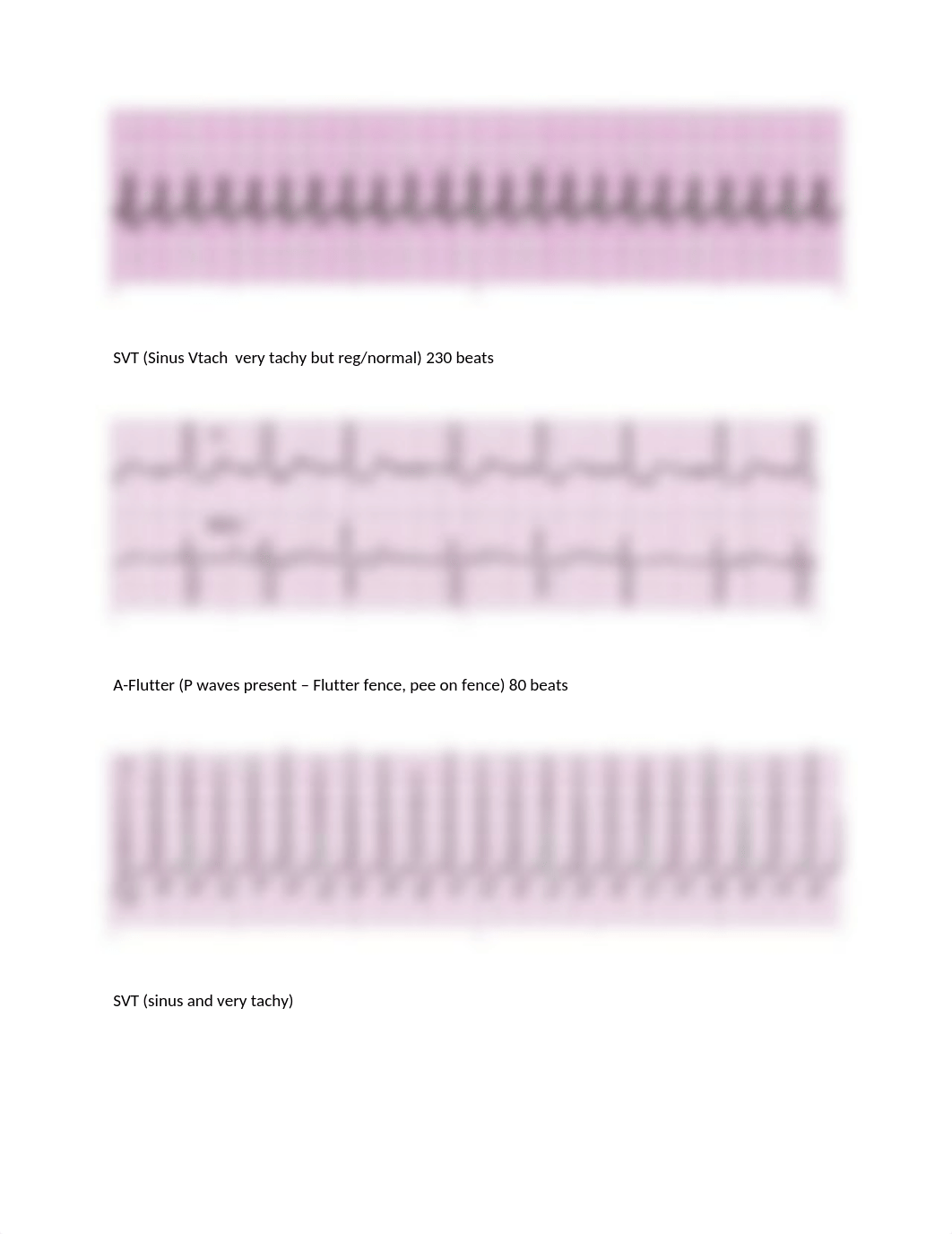 ECG STRIPS SET 1 SKILLS EXAM.docx_d9tnc8tgudv_page4