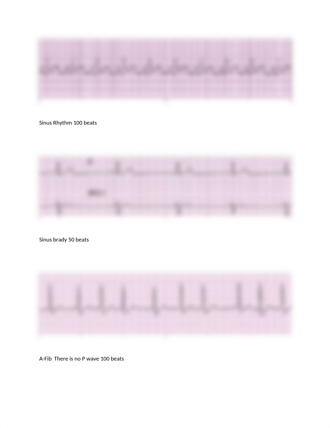 ECG STRIPS SET 1 SKILLS EXAM.docx_d9tnc8tgudv_page3