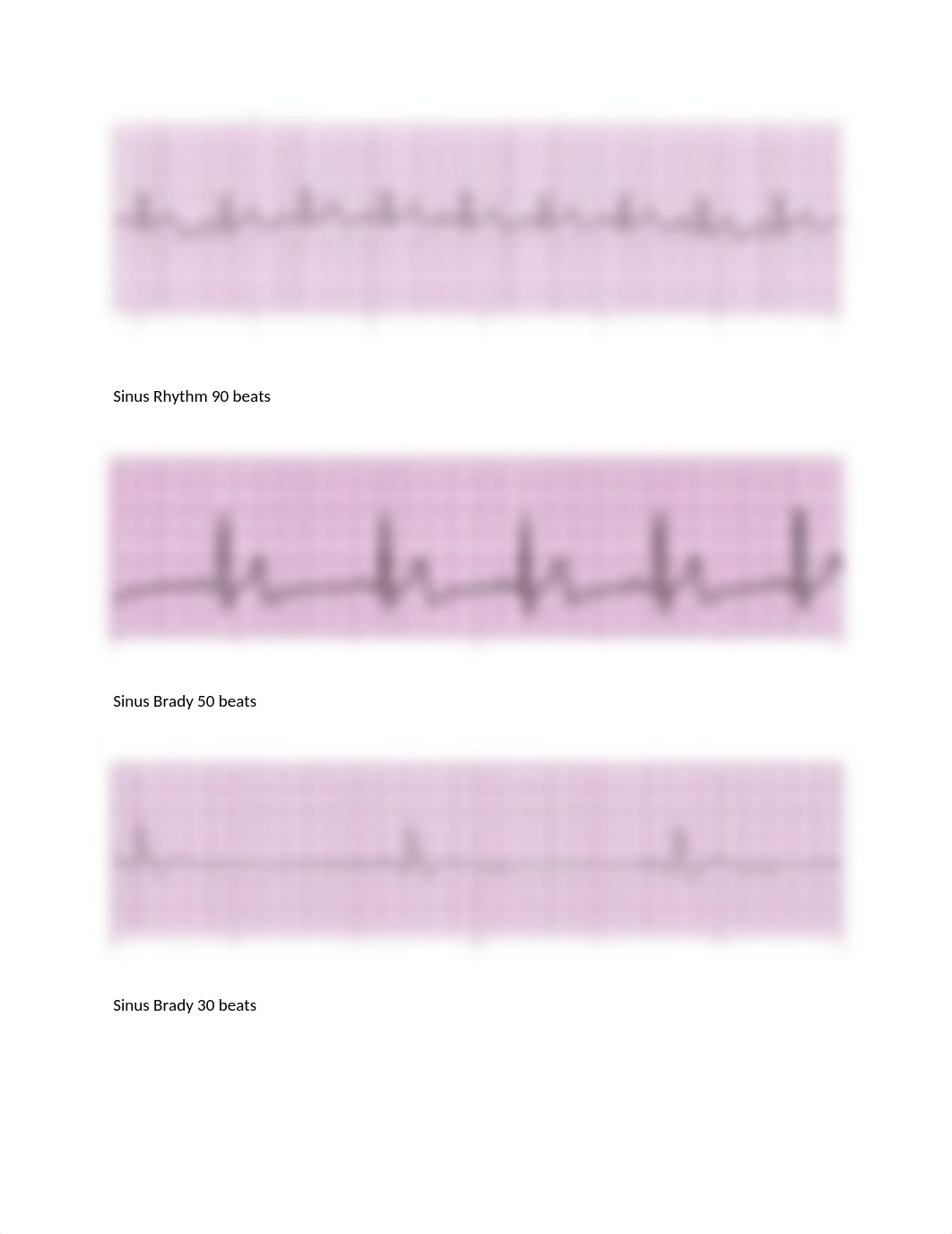 ECG STRIPS SET 1 SKILLS EXAM.docx_d9tnc8tgudv_page2