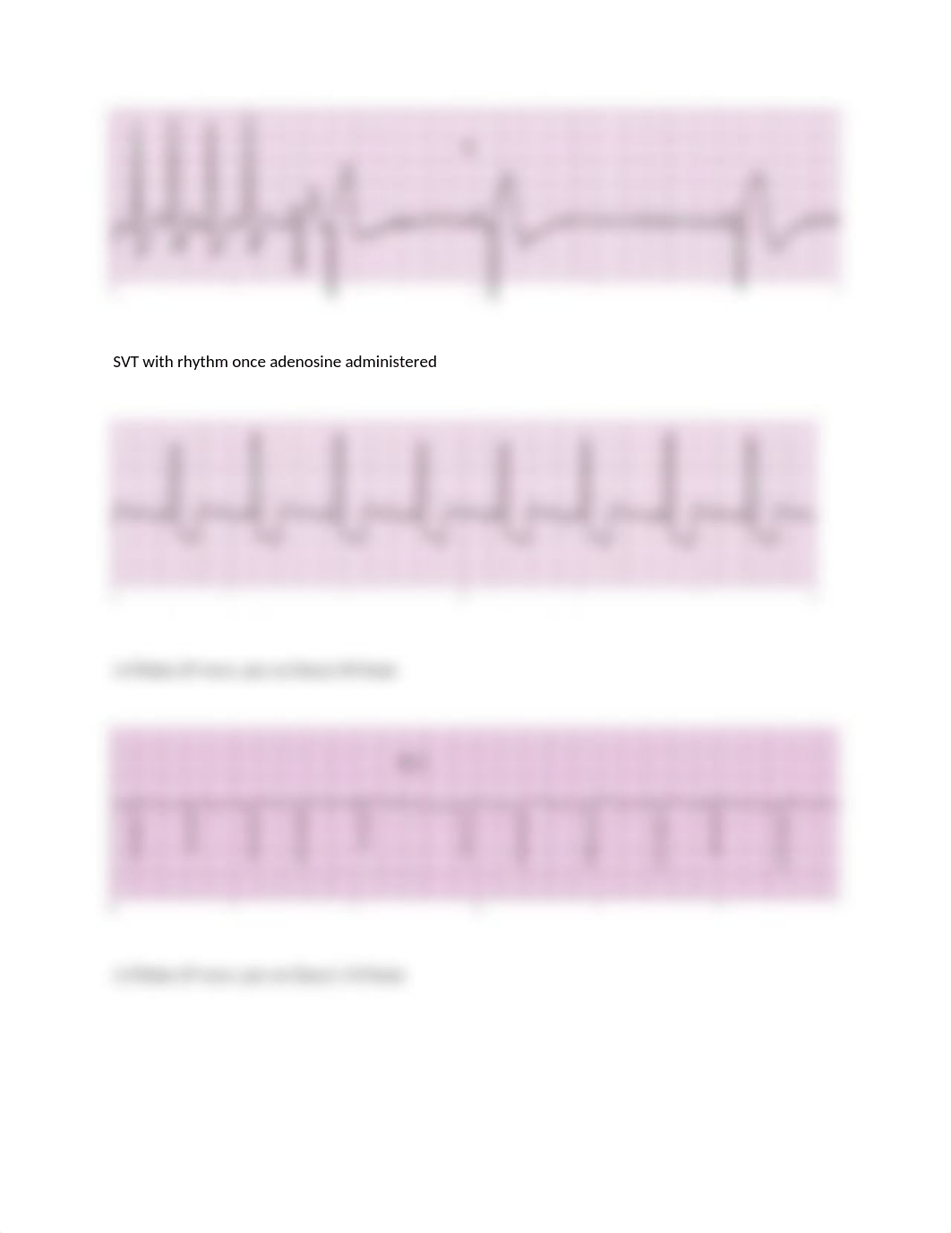 ECG STRIPS SET 1 SKILLS EXAM.docx_d9tnc8tgudv_page5