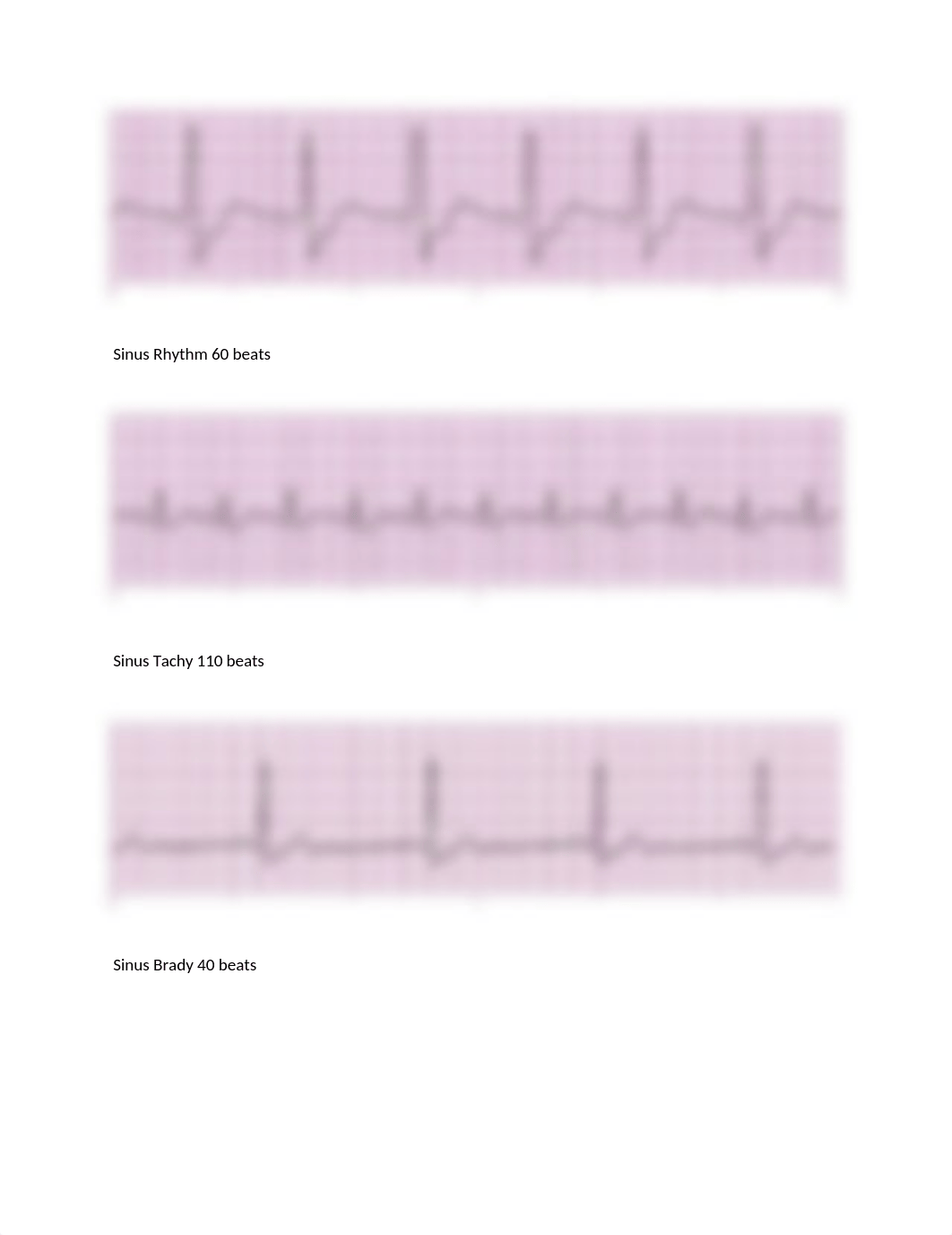 ECG STRIPS SET 1 SKILLS EXAM.docx_d9tnc8tgudv_page1