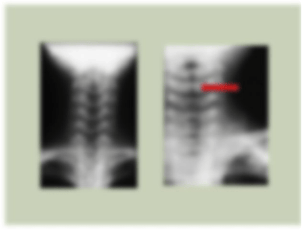 2020_Pediatric RESP_ Case Studies.pptx_d9vlvxs7cey_page5